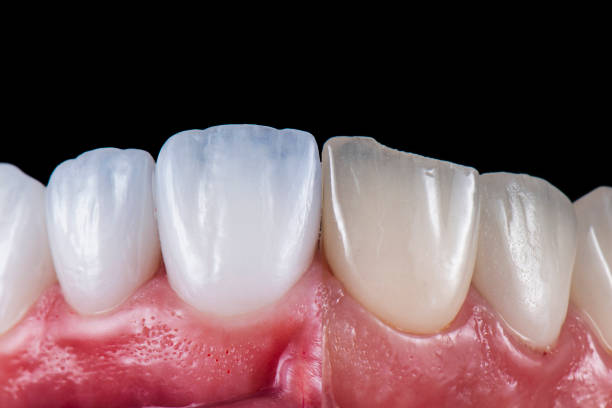 istockphoto-2159387340-612x612-1.jpg